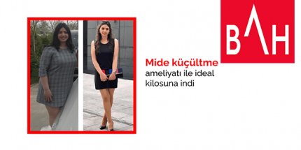 Mide Küçültme Ameliyatı İle İdeal Kilosuna İndi